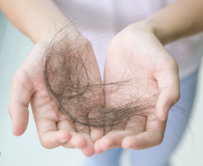 Rụng tóc là gì? 15 nguyên nhân và dấu hiệu thường gặp