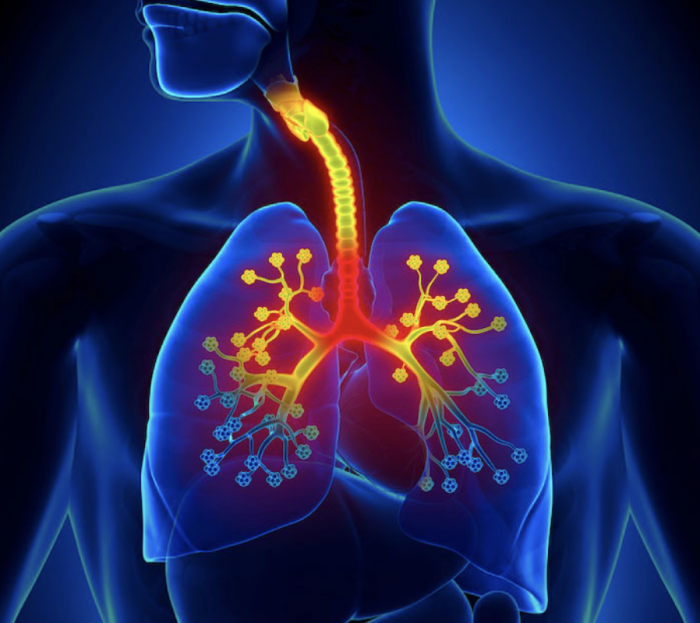 Viêm phế quản phổi: Nguyên nhân, biến chứng và cách phòng ngừa